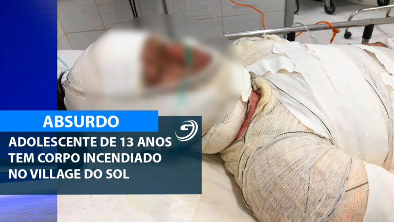 ADOLESCENTE QUEIMADA VILLAGE DO SOL_01