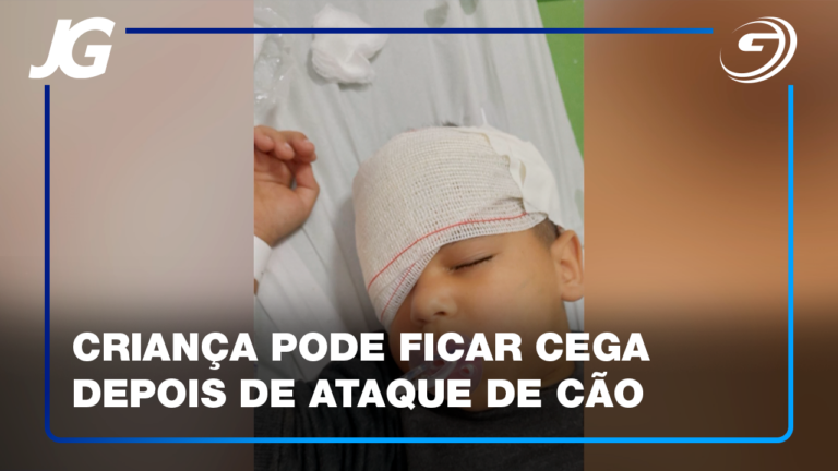 MENINO DE 4 ANOS FOI ATINGIDO NO OLHO DIREITO POR UM CACHORRO VIRA-LATA