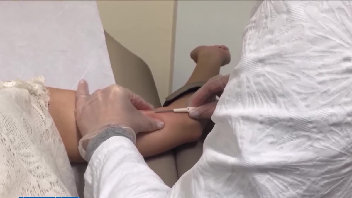 Imagem do implante contraceptivo Implanon e da aplicação no braço