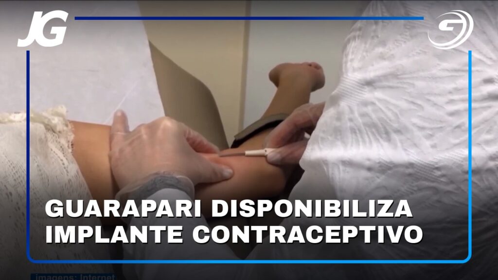 GUARAPARI DISPONIBILIZA IMPLANTE CONTRACEPTIVO
